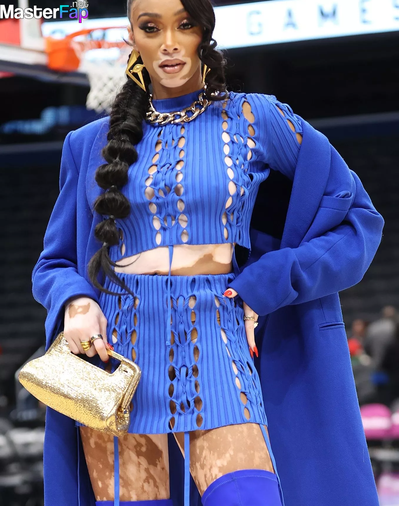 winnie-harlow