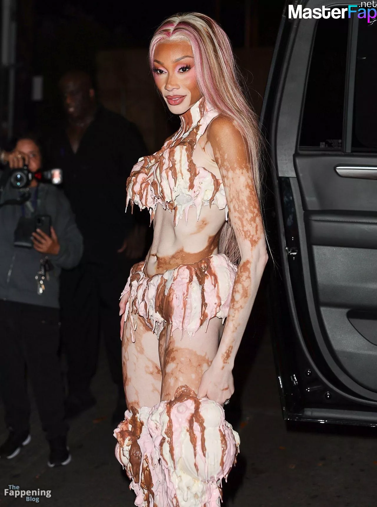 Winnie Harlow Free Leaked Butt Picture