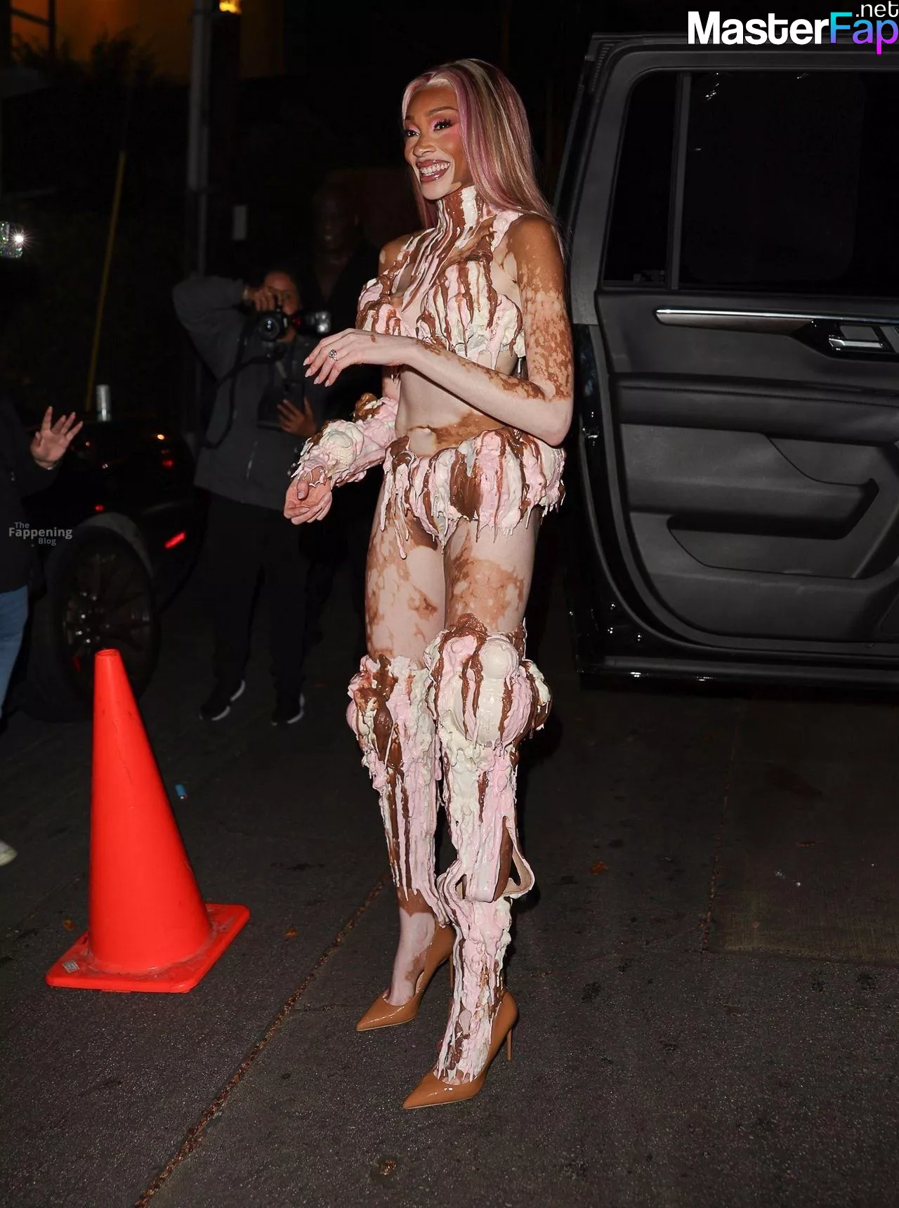 Winnie Harlow Free Leaked Erotic leaks Picture