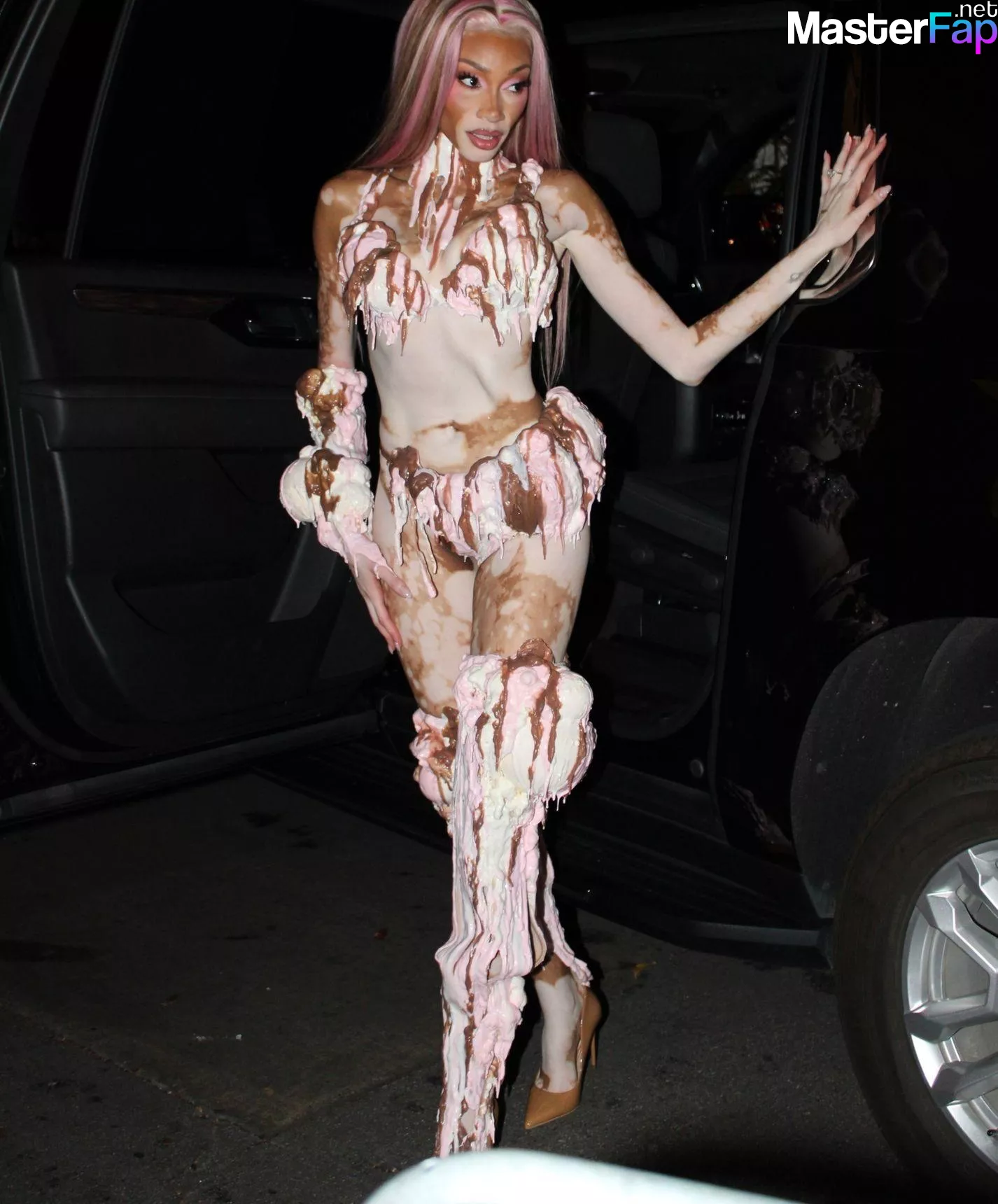 Winnie Harlow Free Leaked Rough leaks Picture