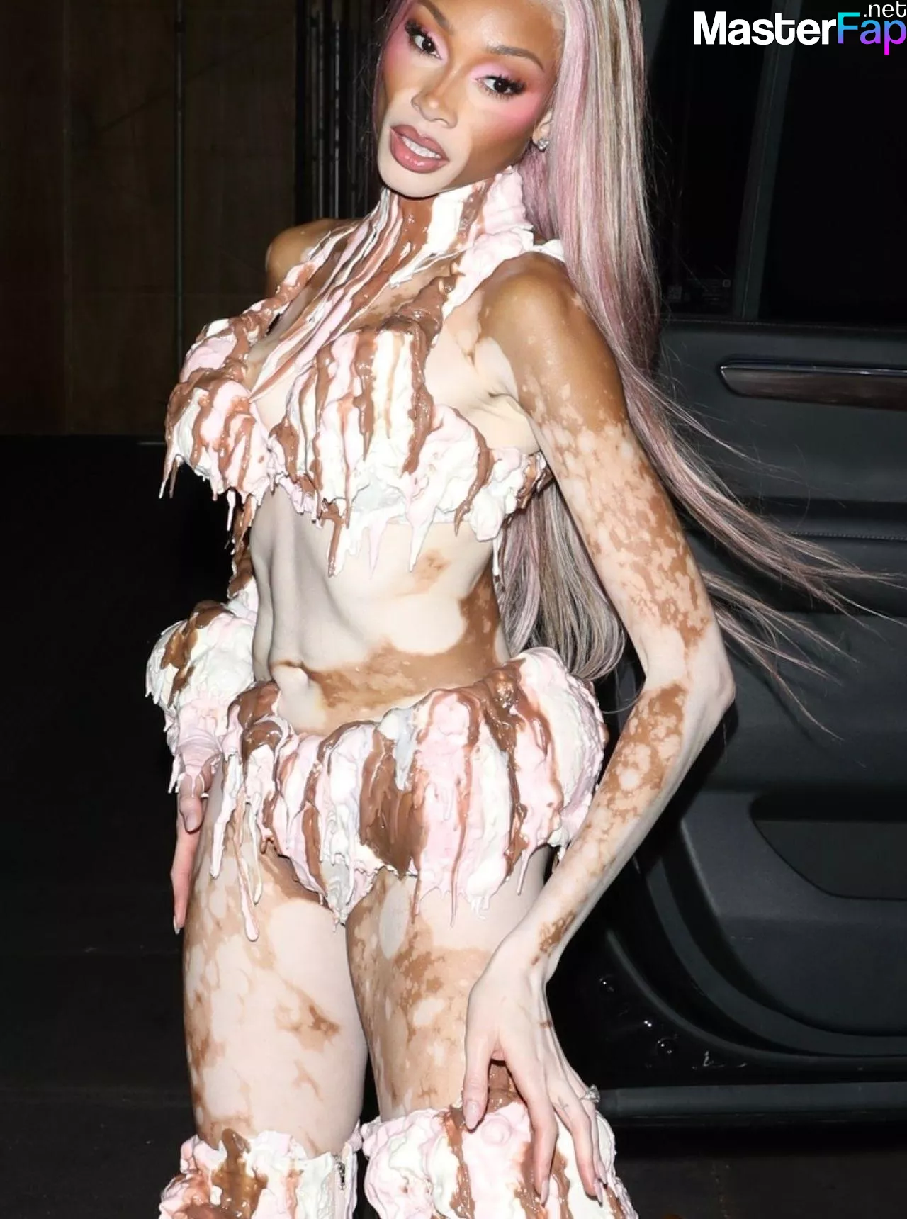 Winnie Harlow Free Leaked Butt leaks Picture