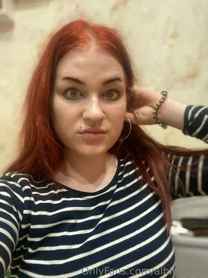 Albinoteen Thumbnail Picture