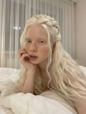Aluumia OnlyFans Leaked Free Thumbnail Picture - #CSl5Mxuh7Q
