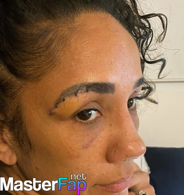 Amanda Serrano OnlyFans Leak Picture - #GdsvpJaO6w.