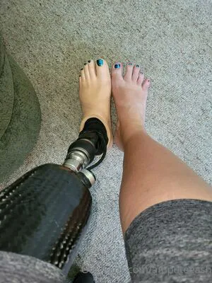Amputeeash OnlyFans Leaked Free Thumbnail Picture - #MTmp8UzPwT