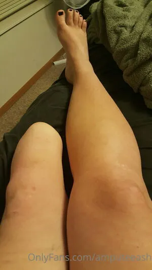 Amputeeash OnlyFans Leaked Free Thumbnail Picture - #SJZ1WMCyxa