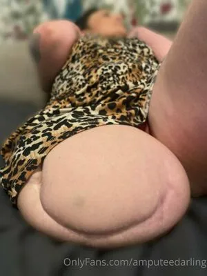 Amputeedarling OnlyFans Leaked Free Thumbnail Picture - #2pSevHvBSX