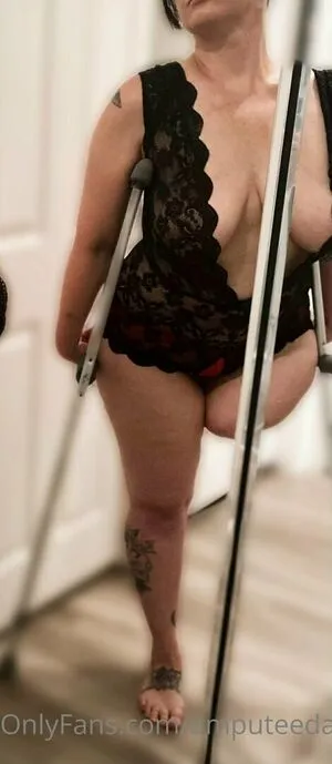 Amputeedarling OnlyFans Leaked Free Thumbnail Picture - #IG8yRu76B0