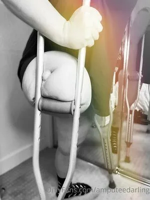 Amputeedarling OnlyFans Leaked Free Thumbnail Picture - #Xn6CnFPp8V