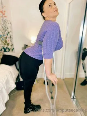 Amputeedarling OnlyFans Leaked Free Thumbnail Picture - #oNgDZynnez