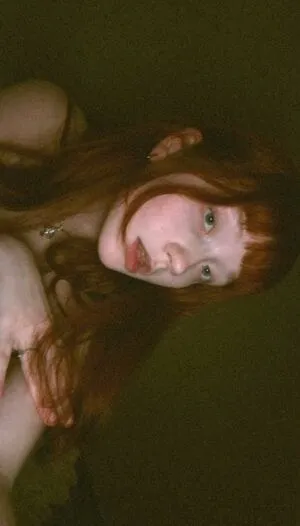 Anacshm Thumbnail Picture