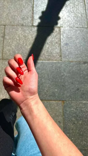 Ane Rot OnlyFans Leaked Free Thumbnail Picture - #gLMNK00cMQ
