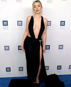 Ava Max OnlyFans Leaked Free Thumbnail Picture - #y9M9IxKqQ8