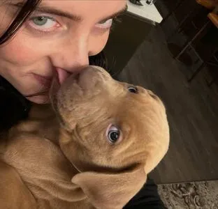 Billie Eilish OnlyFans Leaked Free Thumbnail Picture - #uJpZc8zWfR