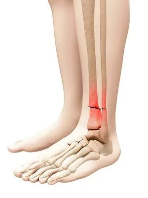 Brokenleg OnlyFans Leaked Free Thumbnail Picture - #AoA9v5Cchj