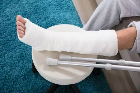 Brokenleg OnlyFans Leaked Free Thumbnail Picture - #kQ3lc2WWLF