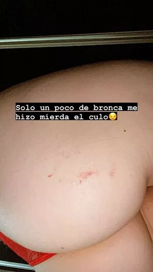 Bun1aca OnlyFans Leaked Free Thumbnail Picture - #s72t2EEvWz