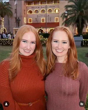 Burinski Twins Thumbnail Picture