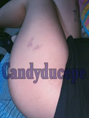 Candyducepe OnlyFans Leaked Free Thumbnail Picture - #5lqfRpuHTs