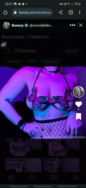 Concealedbones OnlyFans Leaked Free Thumbnail Picture - #CGrTfnfOWv