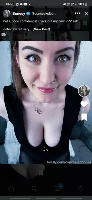 Concealedbones OnlyFans Leaked Free Thumbnail Picture - #rJexQenJid