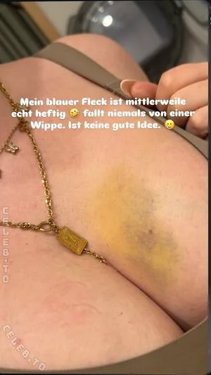 Die Meedtis OnlyFans Leaked Free Thumbnail Picture - #Qp5f7rxkc1