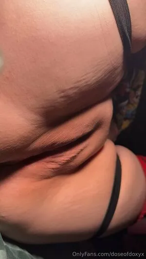 Doseofdoxyx OnlyFans Leaked Free Thumbnail Picture - #YlW88pboLU