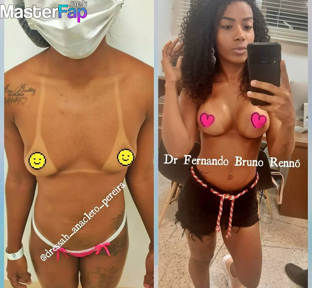 Dressah_anacleto_pereira Nude OnlyFans Leak Picture W8SZWGCE8I |  MasterFap.net