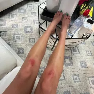 Dua Lipa OnlyFans Leaked Free Thumbnail Picture - #yCvxLB59f7