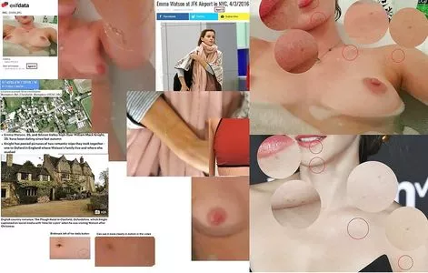 Emma Watson OnlyFans Leaked Free Thumbnail Picture - #EvEdw1uZeP