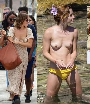 Emma Watson OnlyFans Leaked Free Thumbnail Picture - #kcJsVHhPq4