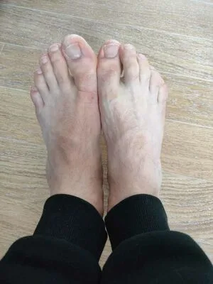 Feetadele OnlyFans Leaked Free Thumbnail Picture - #U6KTgOiZ63
