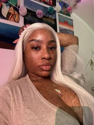 Freckledn OnlyFans Leaked Free Thumbnail Picture - #4VodeWsSQp