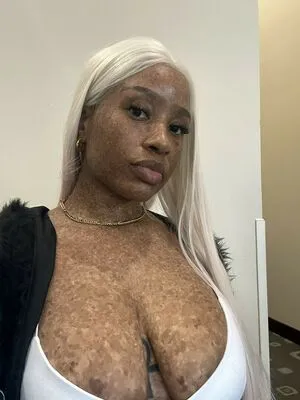 Freckledn OnlyFans Leaked Free Thumbnail Picture - #Bg4ioMiPSV