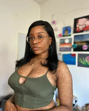 Freckledn OnlyFans Leaked Free Thumbnail Picture - #Ixi44cXdUb