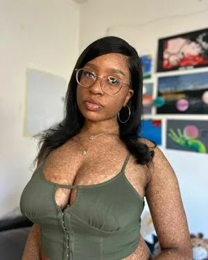 Freckledn OnlyFans Leaked Free Thumbnail Picture - #KN44gIhFFH