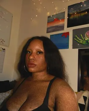 Freckledn OnlyFans Leaked Free Thumbnail Picture - #NUABgoaTjU