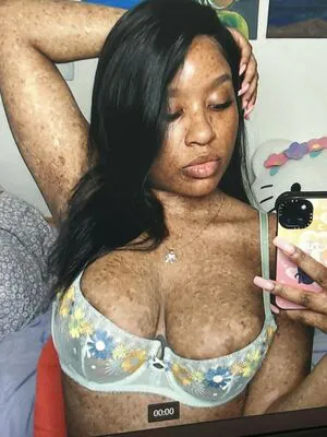Freckledn OnlyFans Leaked Free Thumbnail Picture - #RSjaTWhKtH