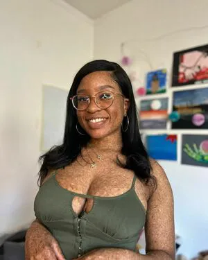 Freckledn OnlyFans Leaked Free Thumbnail Picture - #TBxQbHwid0