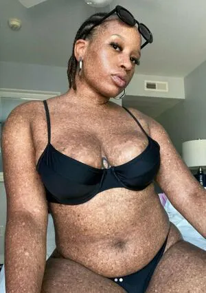 Freckledn OnlyFans Leaked Free Thumbnail Picture - #bkZcsBjodf