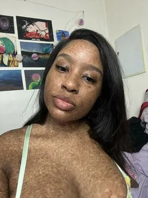 Freckledn OnlyFans Leaked Free Thumbnail Picture - #dZGcUQT6ou