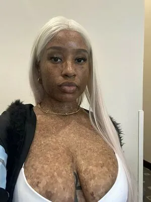 Freckledn OnlyFans Leaked Free Thumbnail Picture - #h3EvcUrbZ0
