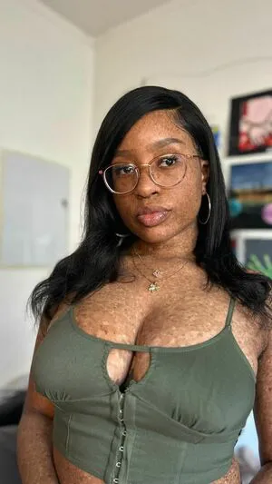 Freckledn OnlyFans Leaked Free Thumbnail Picture - #hC9ggBMjmu