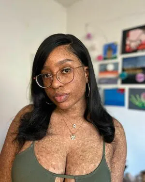 Freckledn OnlyFans Leaked Free Thumbnail Picture - #jcvg6aXTjL