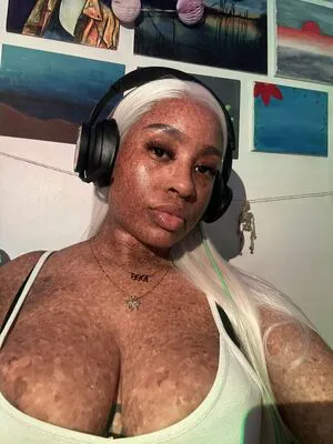 Freckledn OnlyFans Leaked Free Thumbnail Picture - #jlLnLDoImR