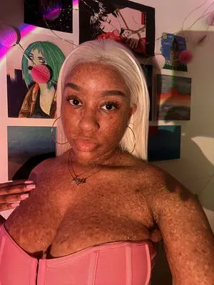 Freckledn OnlyFans Leaked Free Thumbnail Picture - #p0K6F89sT5