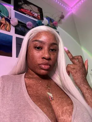 Freckledn OnlyFans Leaked Free Thumbnail Picture - #sr6Hv3RvWn