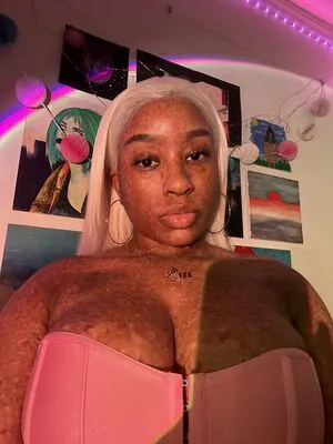 Freckledn OnlyFans Leaked Free Thumbnail Picture - #uj7Ffcx4aL