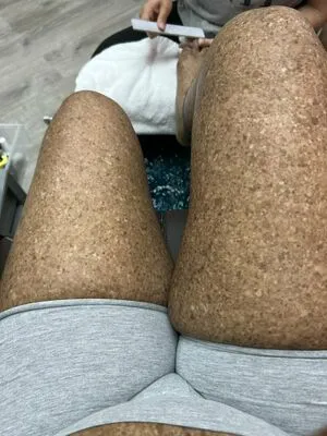 Freckledn OnlyFans Leaked Free Thumbnail Picture - #y4Jr7UZWwN