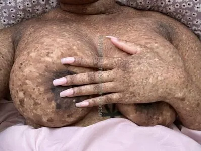 Freckledn OnlyFans Leaked Free Thumbnail Picture - #yw7zXJvfE6